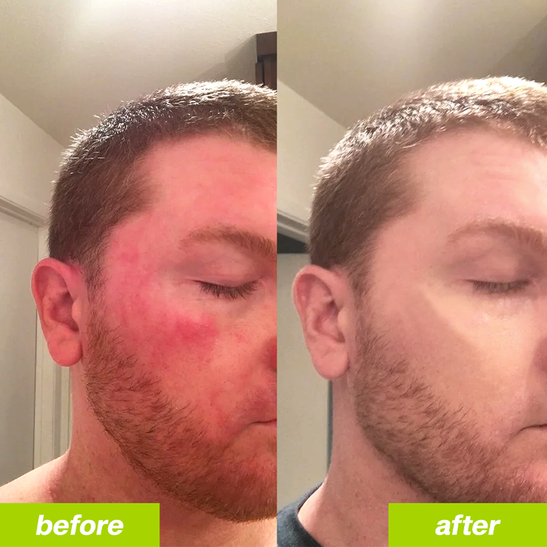 LOCK - Deve Dikeni Detoks