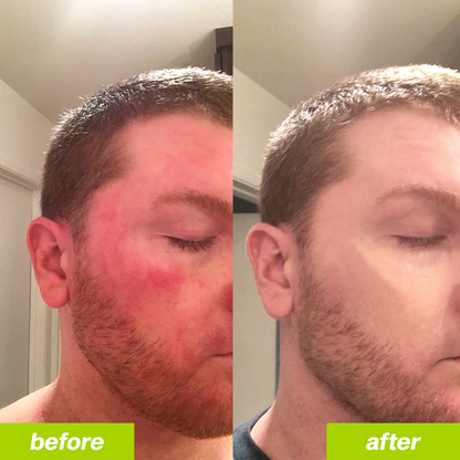 LOCK - Deve Dikeni Detoks